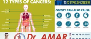 Obesity is linked to 12 different types of cancers.