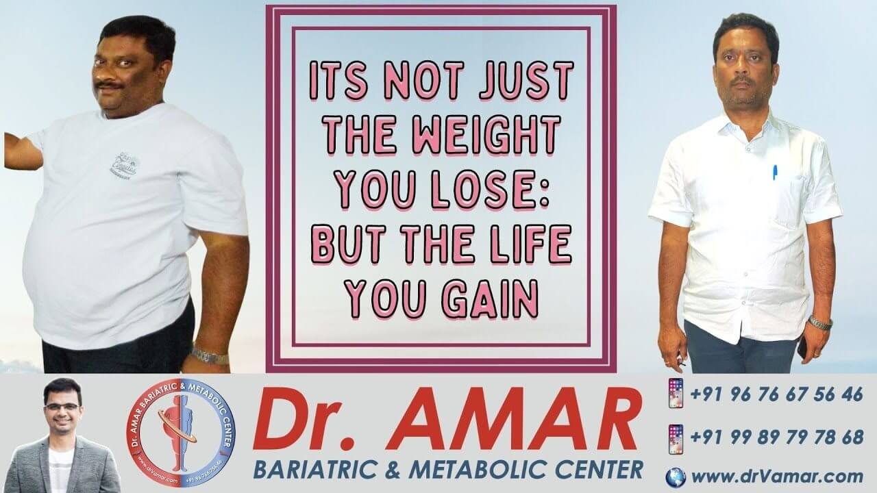 Mr. Ranadheer Reddy Review on Weight Loss Surgery - Dr V Amar