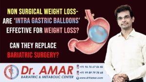 Are Intra Gastric Balloons effective for weight loss?- Can they replace Bariatric Surgery?- Dr. Amar