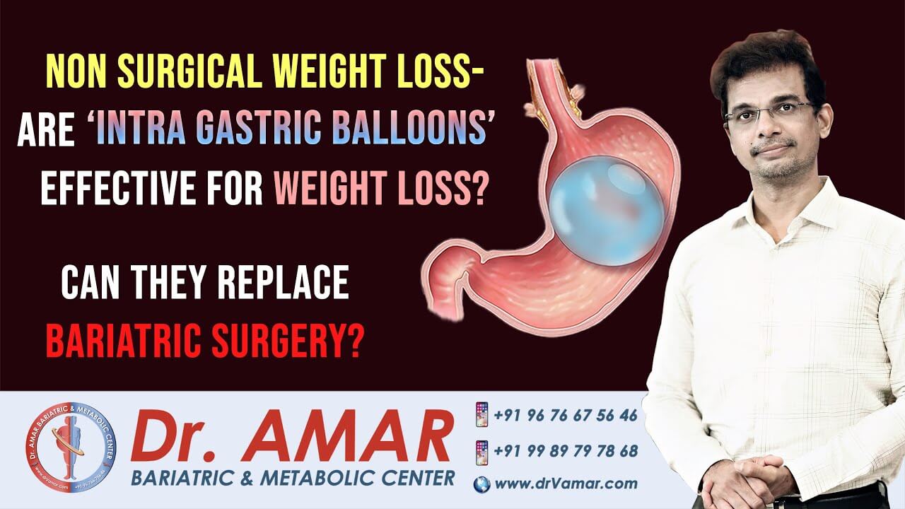 Are Intra Gastric Balloons effective for weight loss?- Can they replace ...