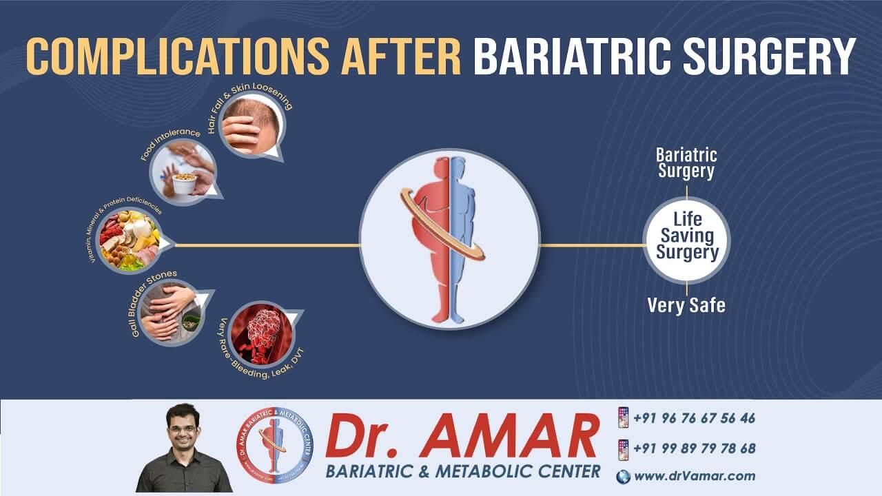 Complications After Bariatric And Metabolic Surgeries Dr V Amar Dr V Amar 3942